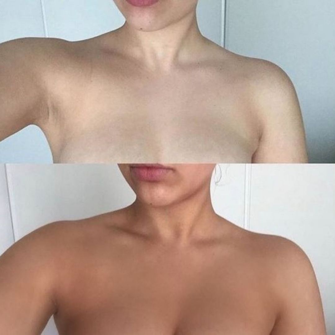 ¿Bronceado sin sol?